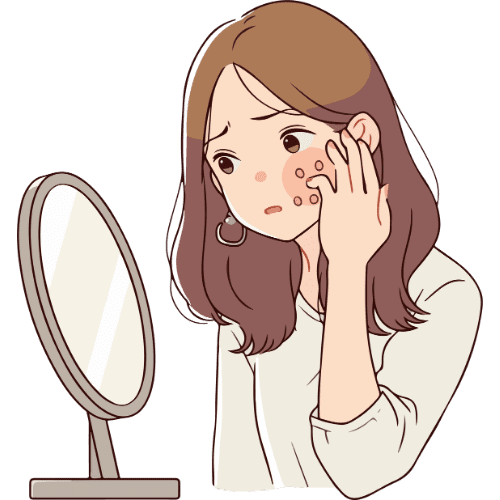 Illustration of a woman looking in a mirror and touching facial pimples, showing acne and skin irritation