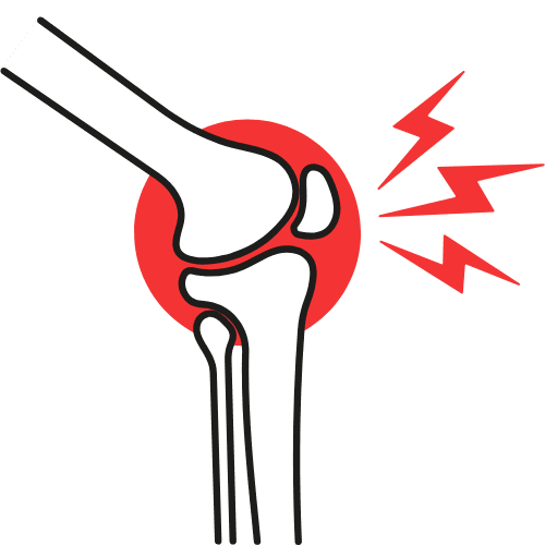 Illustration of a knee joint highlighting joint discomfort and pain with a visual stress indicator.