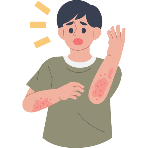 Illustration of a person showing skin rashes and irritation on arms, representing skin discomfort or allergy symptoms.