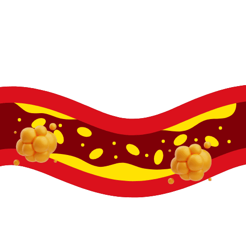 Illustration showing fatty deposits inside a blood vessel, representing cholesterol build-up affecting blood flow.